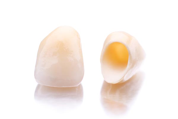 Image of two dental crowns